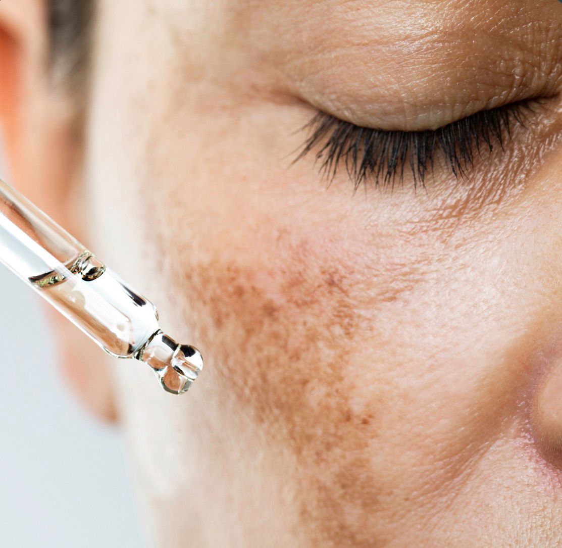 Tranexamic Acid: A Modern Ingredient for Bright and Even Skin